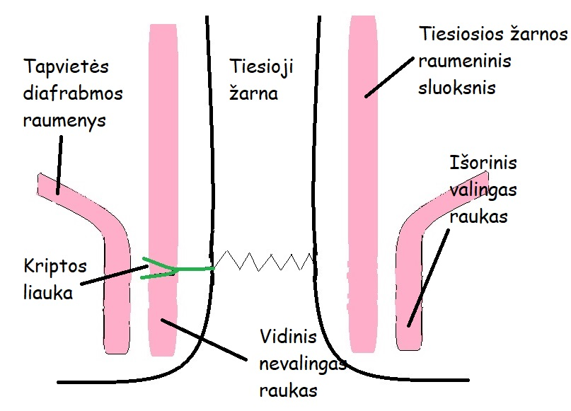 1 paveikslėlis. Tiesiosios žarnos ir išeinamosios angos kanalo anatomijos schema.